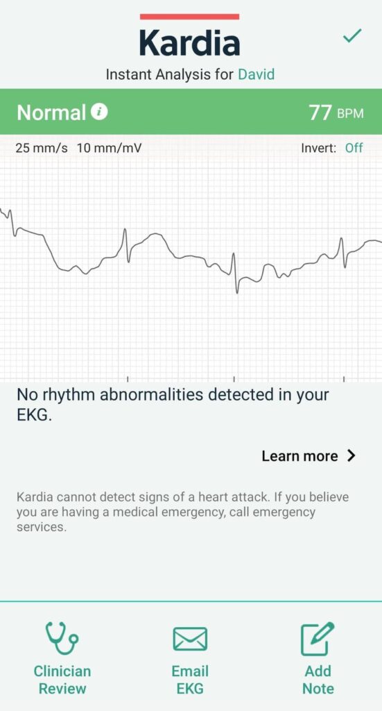 The KardiaMobile Card Review: Accurate ECG Recording and Analysis